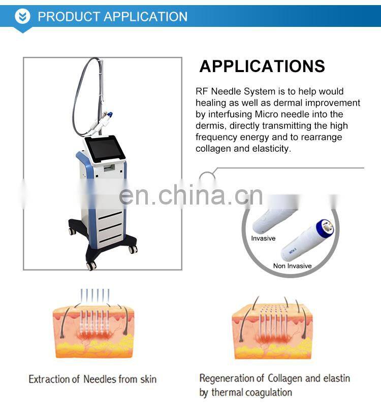 Beijing Lefis rf metal tube pore tightening machine stretch marks removal
