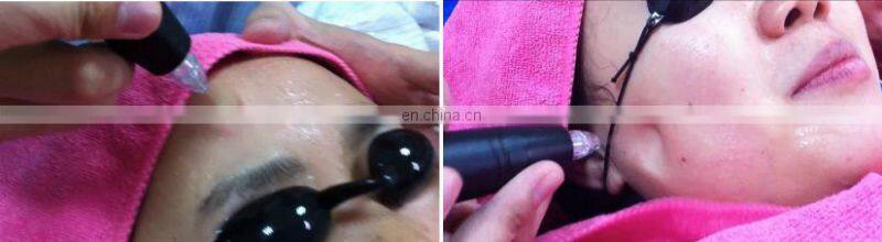 Niansheng Professional Newest Jet Peel Oxygen Water Facial Jet Peel Beauty Machine