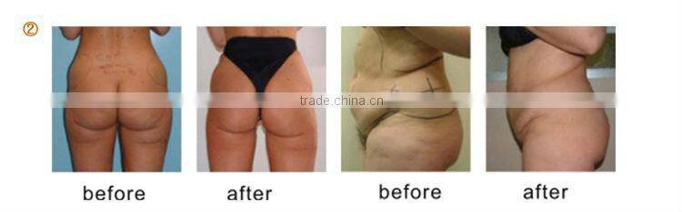 New Products 2014 Lipo Laser Cavitation Slimming Machine Cavitation Machine Price