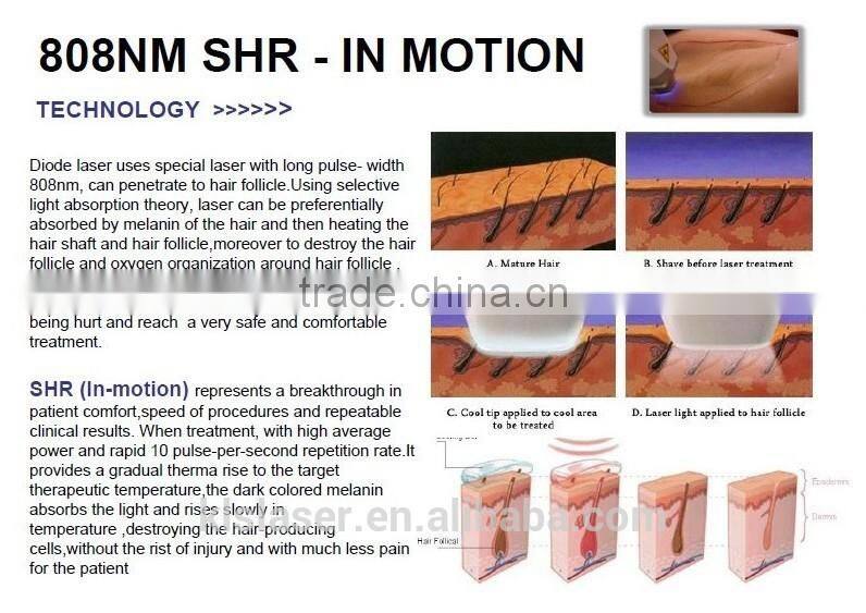 Wholsale High Quality 808nm Diode Laser Hair Removal Machine/laser hair removal for sale