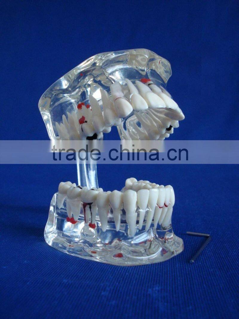 Dental adult pathological dentition model DEA-48 teeth model teaching demonstration