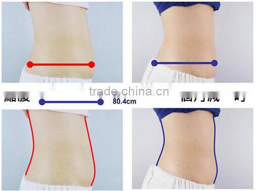 Small Mini Cryo slim freezer weight loss belt BD02