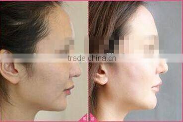 Skin Care System/LED/PDT Skin Rejuvenation Machine