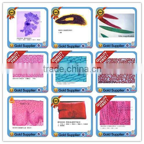 adamantoblastoma oral pathology prepared slides/teaching oral pathology slides/medical oral pathology slides