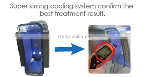 Nubway cryotherapy portable cryo machine