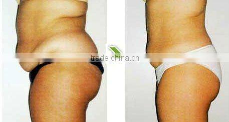 Anti cellulite Far infrared slimming suit F015