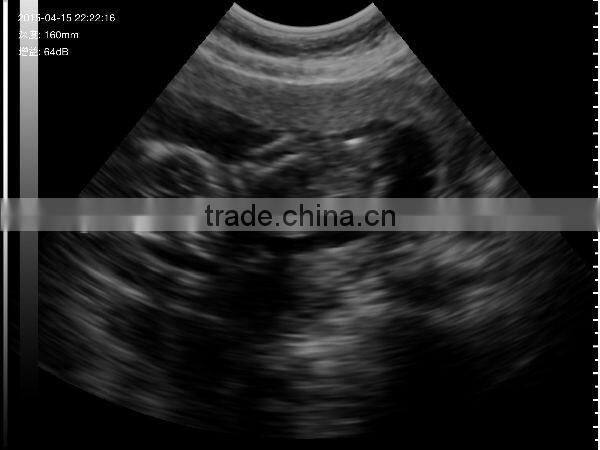 UProbe-1 Wireless Probe Ultrasound Scanner