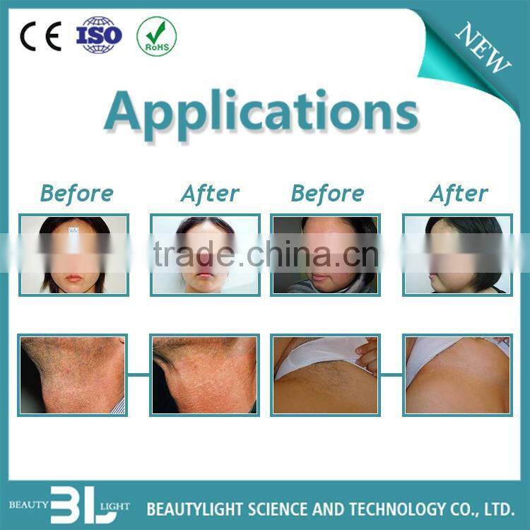 Fast E-light fast IPL