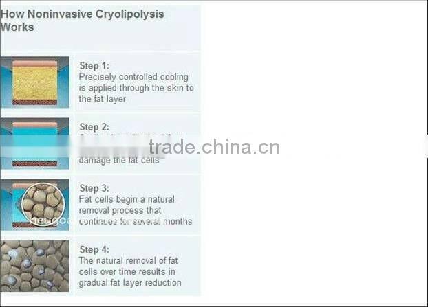 Medical CE approved Cryo anti cellulite massager