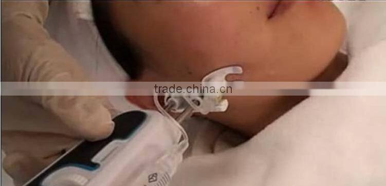 new innovative product hand use meso injector mesotherapy gun machine u225