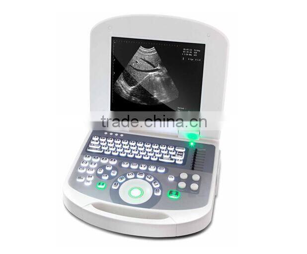 Laptop Ultrasound Scanner RUS-2200 type B ultrasonic for sale