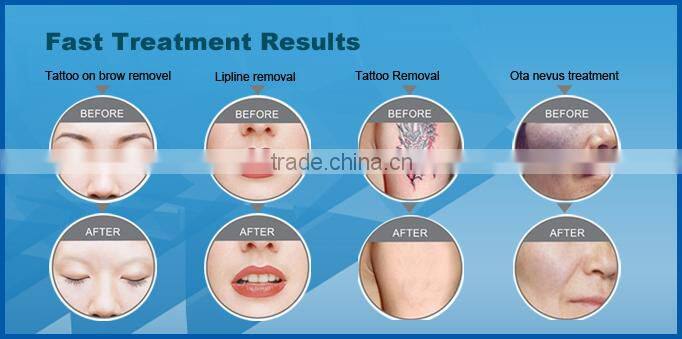 Promotion elight beauty salon equipment