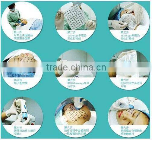 Table Facial Fractional rf skin tightening machine, radio frequency with cheaper price -F-TJ03