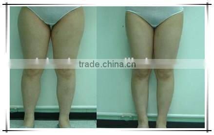 Most Advanced slimming tech far infrared cavitation cellulite massage lipo laser machine