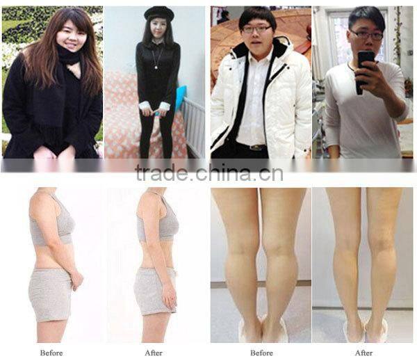 VG-606C Poratale ultrasonic facial blackhead extraction machine with Ultrasound &Vacuum liposuction function