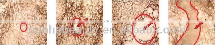 UK distributor wanted cavitation rf, fast cavitation slimming system, cavitation machine price