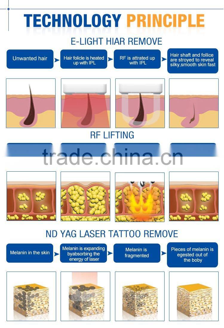 Professional ipl elight laser hair removal machine with best quality