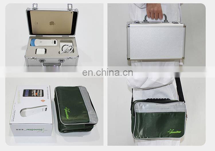 Sales 2022 factory price portable wireless ultrasound scanner ultrasound machine