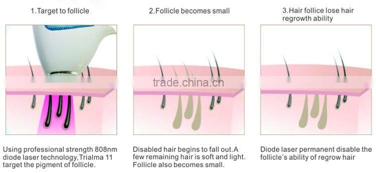 35%OFF! 808nm Laser Diode price/High power Laser Diode for hair removal(CE Approved)