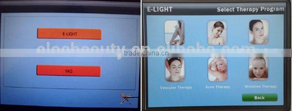 Best Quality Spa Use ipl hair removal,laser ipl hair removal machine/ipl machine