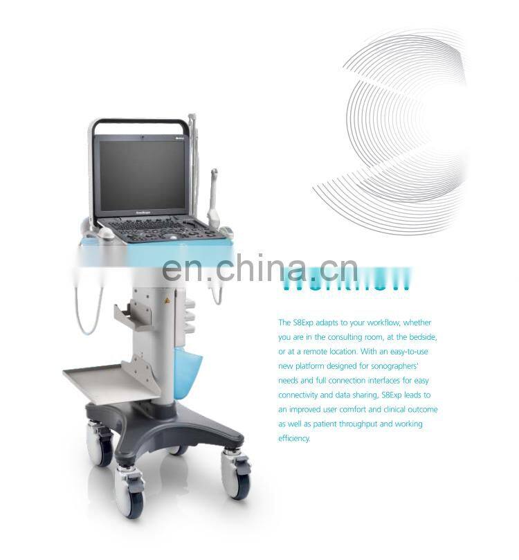 Professional 4D Color Doppler Sonoscape ultrasound scanner/Portable Sonoscape S8 EXP/Sonoscape ultrasound