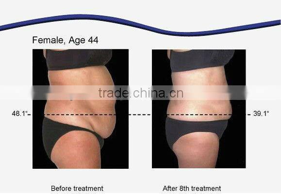 hot selling fitness equipment body slimming machine