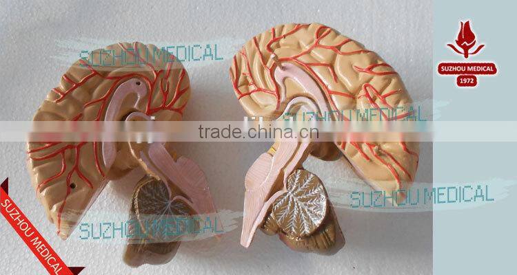 Distribution of brain and cerebral arteries