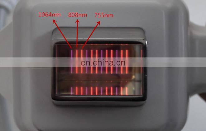 3 ondas hair removal machine 755 808 1064 laser 3 ondas alemania Soprano ice platinum alma laser hair removal