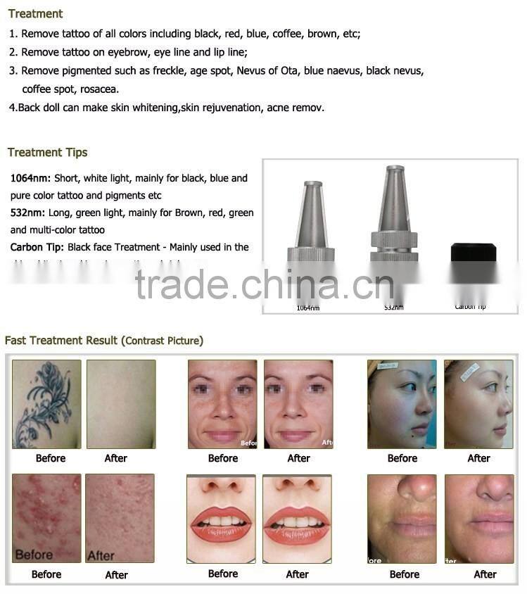 Best quality tattoo laser remover machine for beauty clinic use
