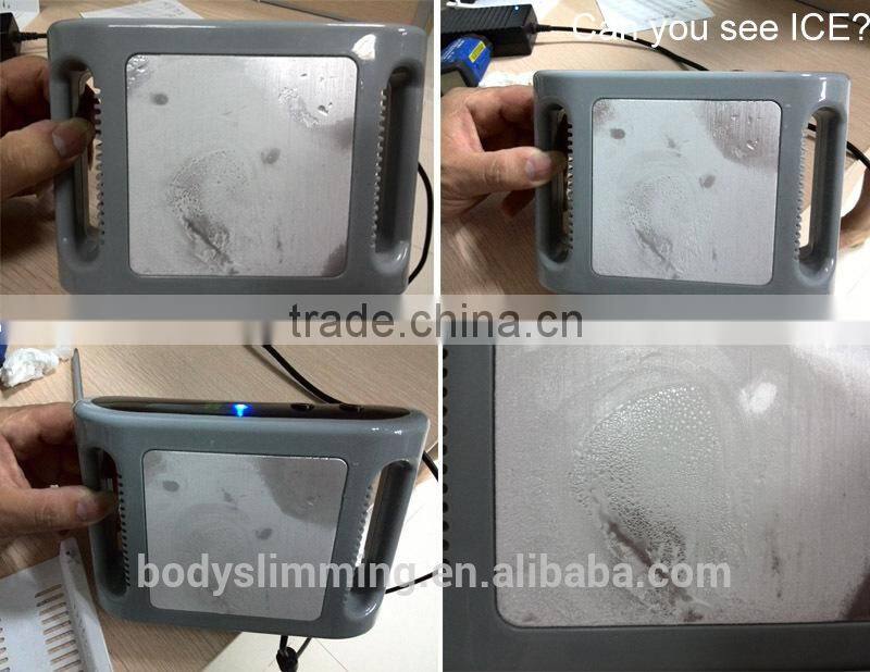 Professional Fat Freezing Mini Cryolipolysis For Home Use