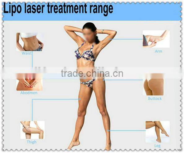 AF-S33 slimming Liposuction Laser machine lipo
