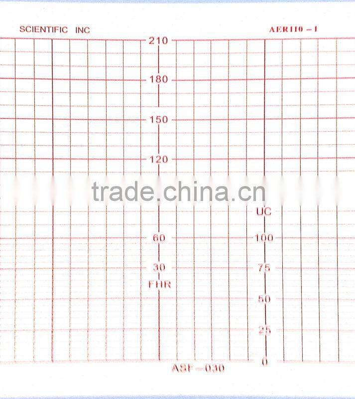 Fetal Monitor Paper / 116mm*100mm-150p Fetal Monitor Recording Paper for Analogic Scientific ASF-020