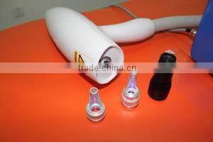 tattoo removal laser / ng yag laser / laser nd yag 1064 hair removal