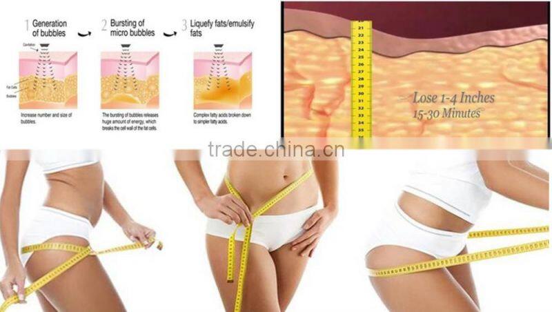 rf cavitation / cavitation rf vacuum machine / best ultrasound cavitation machine