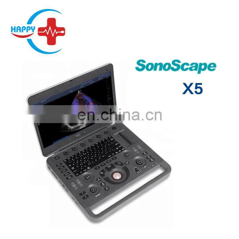 Great performance Sonoscape x5 portable ultrasound probe/Ultrasound diagnostic/Sonoscape
