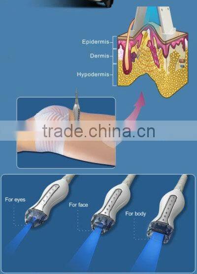 2013 Hottest portable rf remove wrinkles machine portable rf radio frequency machine(wrinkle removal quickly!!!!)
