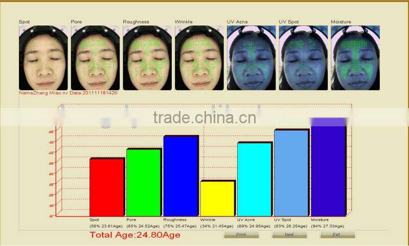 Portable skin scope spectrum skin scanner analyzer machine/with CEdigital skin analyzer