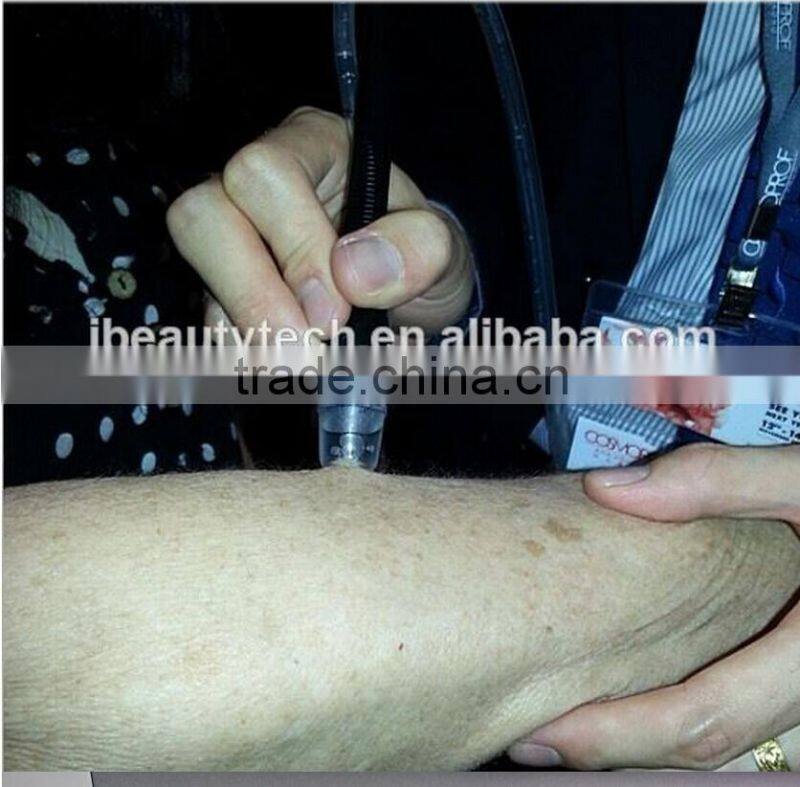 2016 New product SPA9.0 SPA dermabrasion/dermabrasion machine/ dermabrasion water dermabrasion