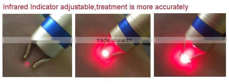 permanent remove vascular machine by 980nm diode laser