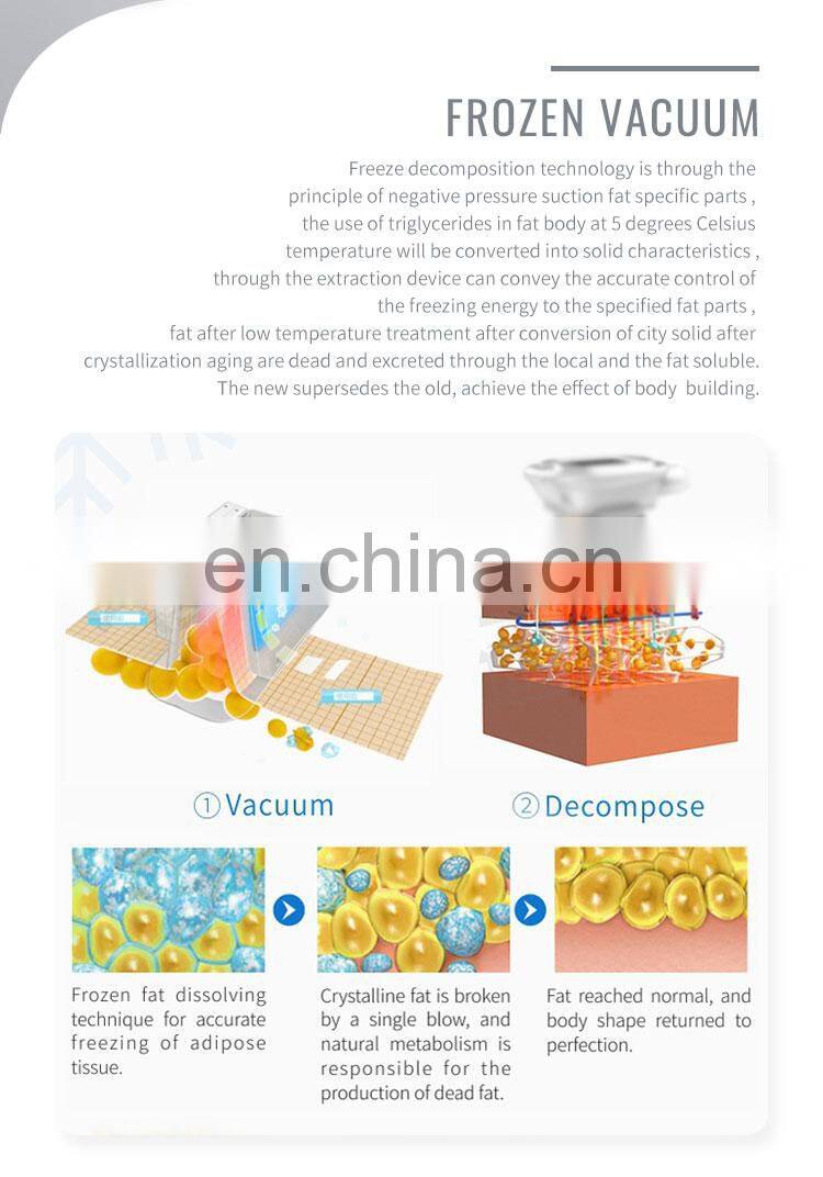 Factory selling 2020 renlang weight loss fat freezing machine cool cryo 40k rf lipolaser