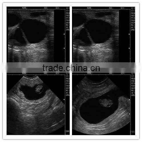 New Nesign Ecografo Veterinario With CE