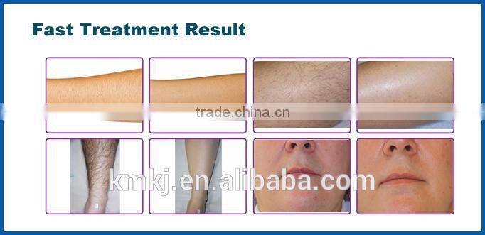 2016 Newest upgrade portable laser diode 808 hair removal