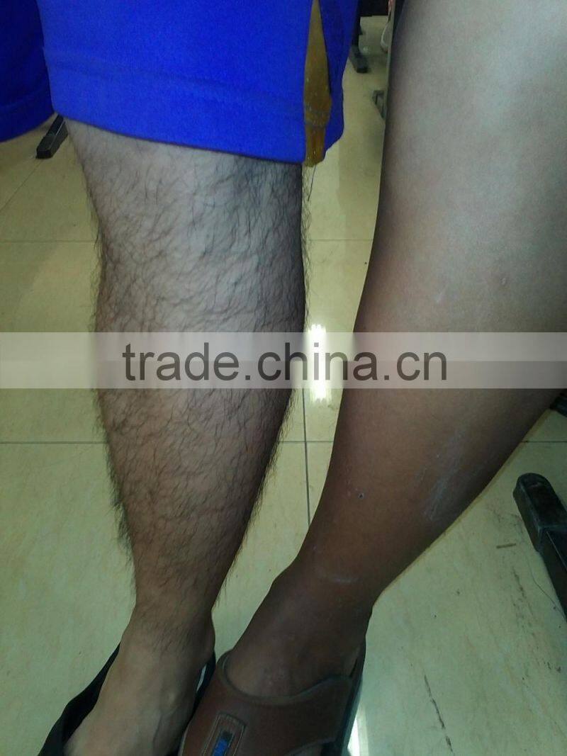 Surgical instruments permanent body hair remover laser