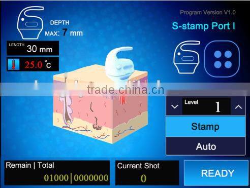 2016 liposonix hifu slimming equipment / liposonix LANGDI ORIGINAL FACTORY