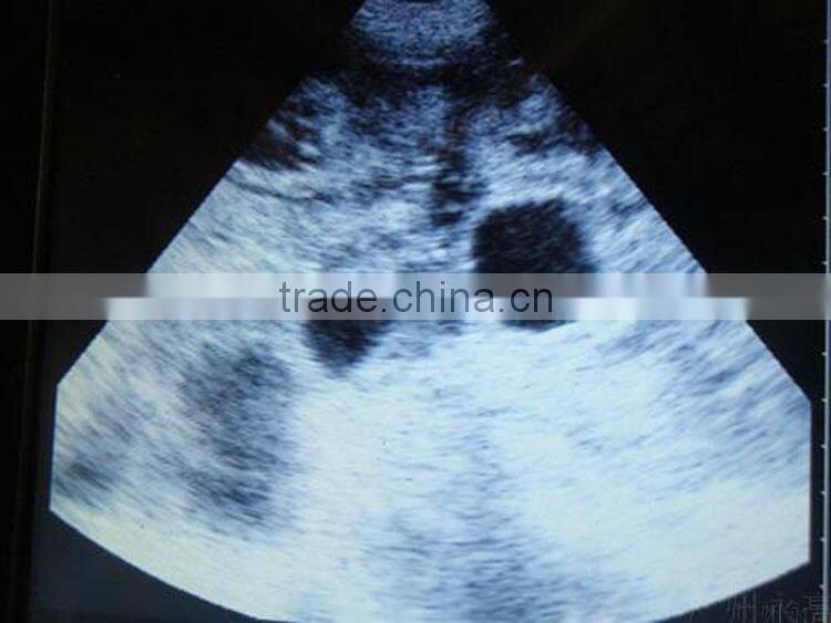 Veterinary Digital Handheld Ultrasound Scanner