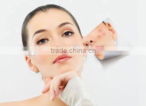 GTO 540 dermaroller microneedle rollerfor skin care from professional factory