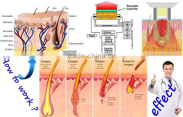 Professional E-light IPL permanent hair removal equipment rf skin rejuvenation