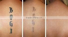2016 Portable nd yag laser tattoo removal machine /laser tattoo removal equipment for spa/clinic/hospital