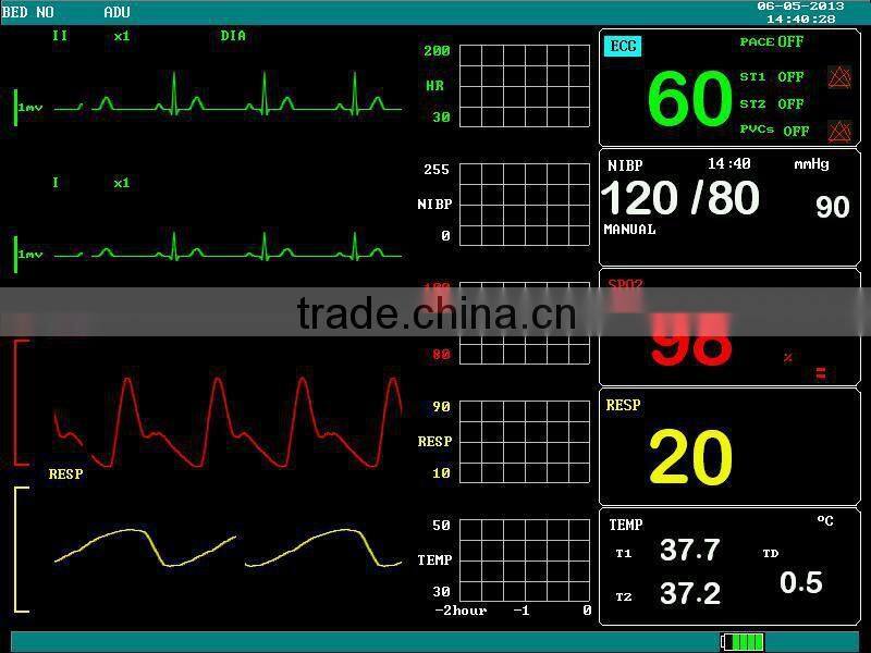 F5 Portable Multi-Parameter Monitor (12.1 inches)