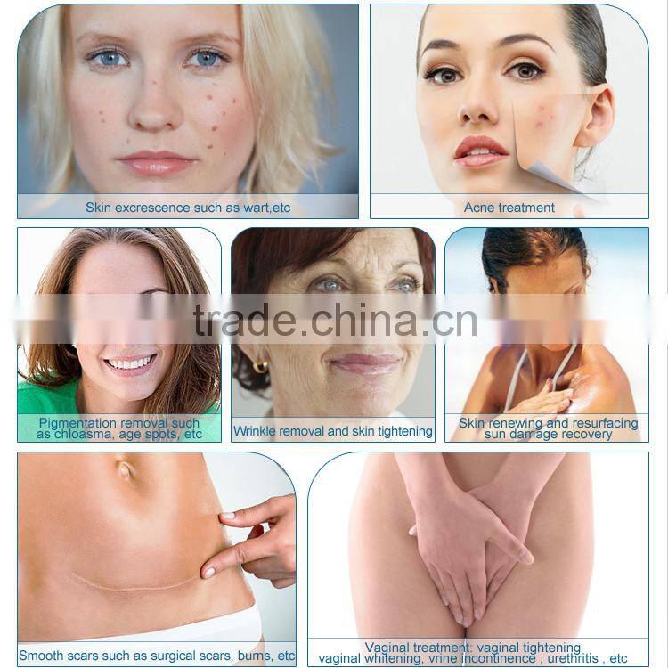 co2 fractional laser system for shrink vagina